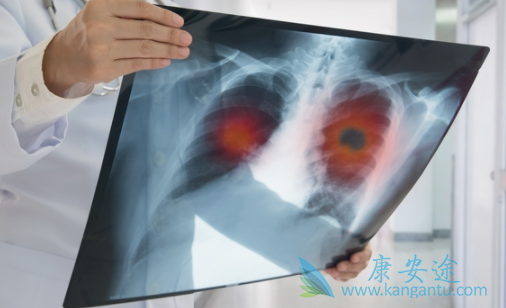 克唑替尼 克唑替尼