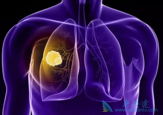 ��ƥ����