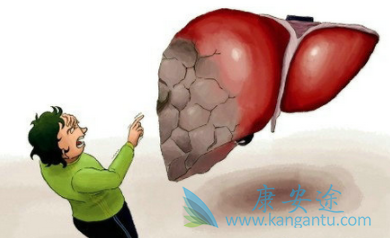 乙肝常识 乙肝常识