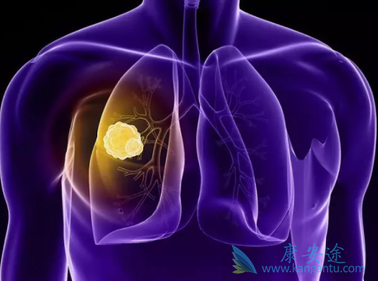 �ΰ���ת��