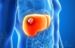 ���ڸΰ����ƳԿ�������(Cometriq)������Щ���棿