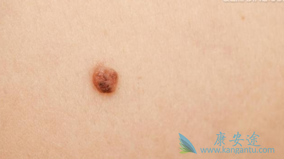 ��ɫ��������