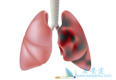 ����ҩ�����������İ�ȫ��Ҫ�ȶ���������