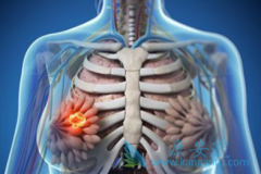 �����鵥��(Perjeta)�����������ٰ����ߵ������ڴﵽ56.5����