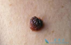 ��������Ƥ����ɫ���������е��о���չ