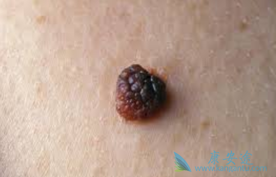 ��ɫ��������