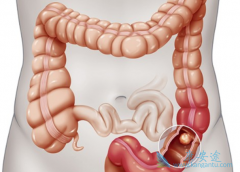 �����������Խ�ֱ��������Ч���ڱ����鵥��