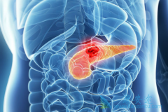 �������������ٰ������еĵ�λ����������FOLFIRINOX����ȡ��