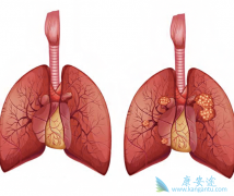 Ŀǰ��������Էΰ�egfr�е�İ���ҩ������Щ��