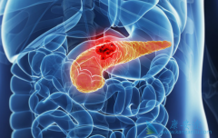 �����������������ٰ����Ƶı�׼���Ʒ�����