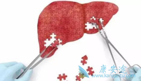 丙肝怎么治疗 丙肝怎么治疗