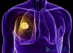 �ΰ����ڻᷢ����Щת�ƣ��ΰ���ת�ƻ�����ߴ�����Щ���⣿