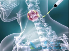 �����ܰͰ��ܻ��ã��ܰͰ��ķ���������Щ������أ�