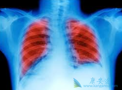 Сϸ°û·Î°© Сϸ°û·Î°©