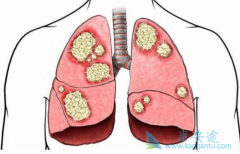 �������������ڼ����©����һ����Ҫ������