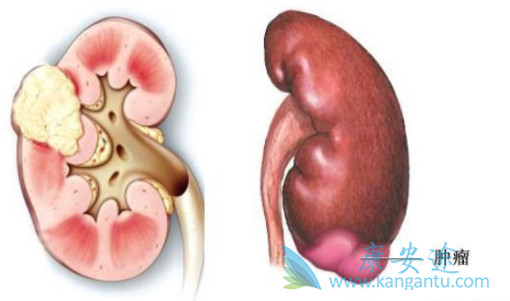 舒尼替尼 舒尼替尼