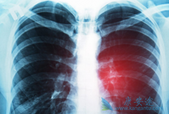 ����̩/�����������϶��ȿ����Ը��Ʒ��ٰ����ߵ���ǻ��Һ֢״