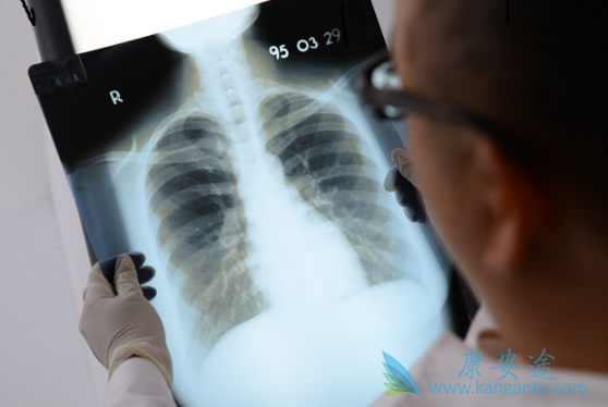 小细胞肺癌 小细胞肺癌