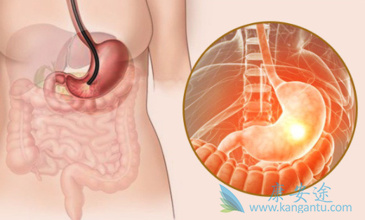 胃癌能活多久 胃癌能活多久