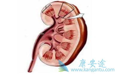 中晚期肾癌能活多久 中晚期肾癌能活多久