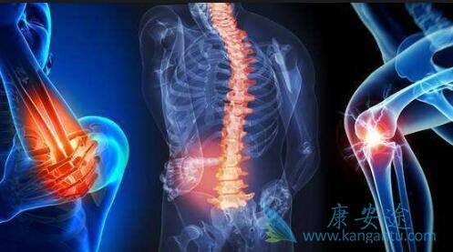 多发性骨髓瘤 多发性骨髓瘤