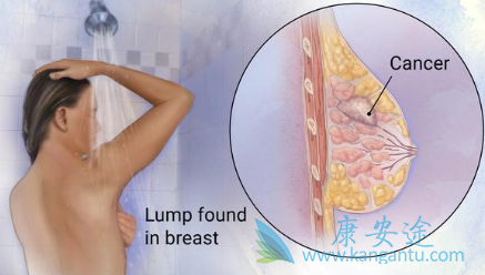 1547173725367835.png image.png