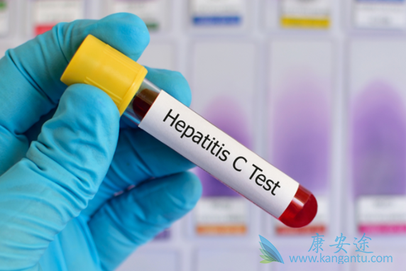 丙肝可以治疗好吗 丙肝可以治疗好吗