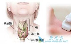 ���Լ�״����������Щ֢״������������ԺͶ��Լ�״��������