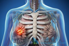 ��Щ���ٰ�������Ҫ�����鵥���������ƣ�