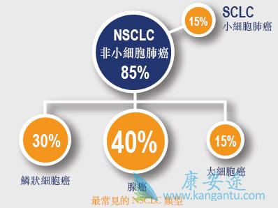 小细胞肺癌 小细胞肺癌