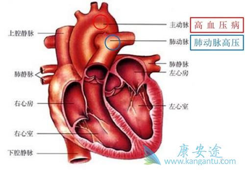 肺动脉高压 肺动脉高压