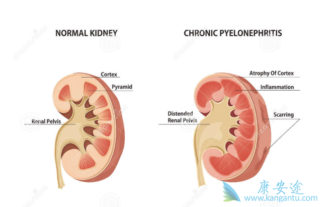 突破性疗法认定 突破性疗法认定