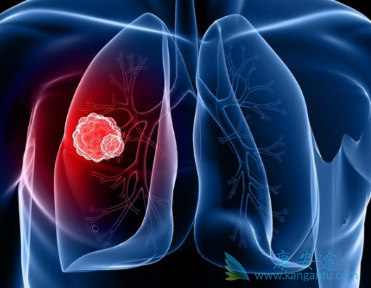 肺癌egfr靶点 肺癌egfr靶点