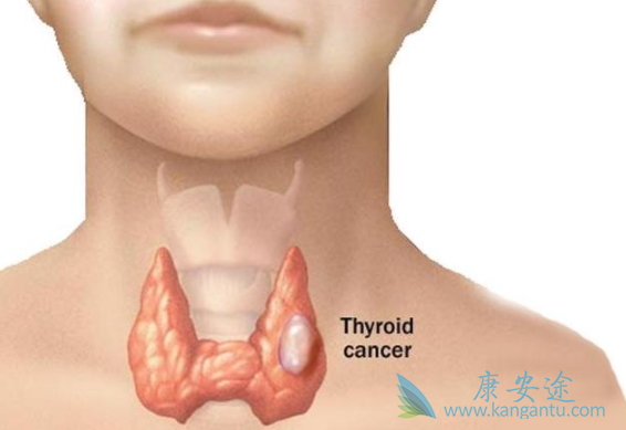 甲状腺肿瘤怎么治疗 甲状腺肿瘤怎么治疗