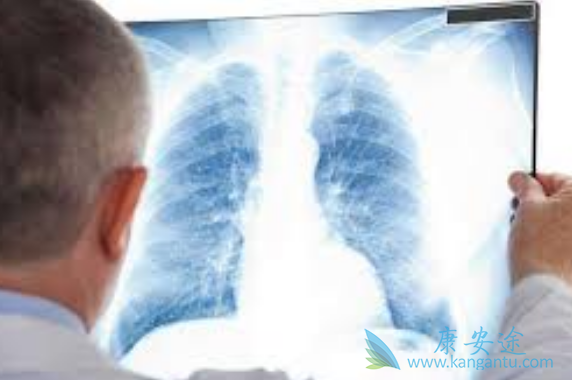 肺纤维化 肺纤维化