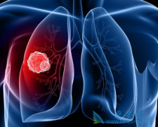 �ΰ�������ʲô֢״����������ʲô��ͬ��