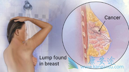 HER2阳性 HER2阳性