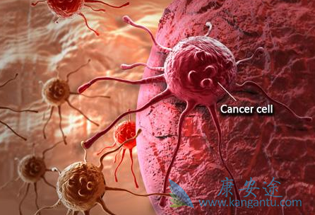 肺癌晚期 肺癌晚期