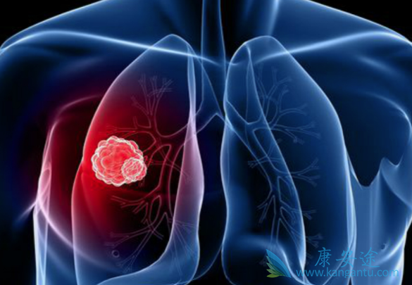 纳扎替尼 纳扎替尼