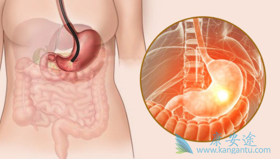 胃癌能活多久 胃癌能活多久