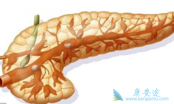 胰腺癌治疗 胰腺癌治疗