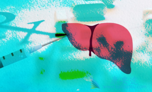 丙肝怎么治 丙肝怎么治