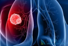 ���ڷΰ����κ����������͵ķΰ������Σ�