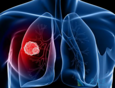 �β�С����Ƿΰ�ǰ���𣿷ΰ����κ���