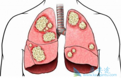 ������������Ȱ���������и��õĿ�Ѫ����������