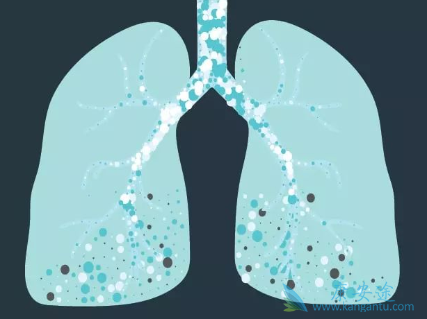 肺纤维化 肺纤维化