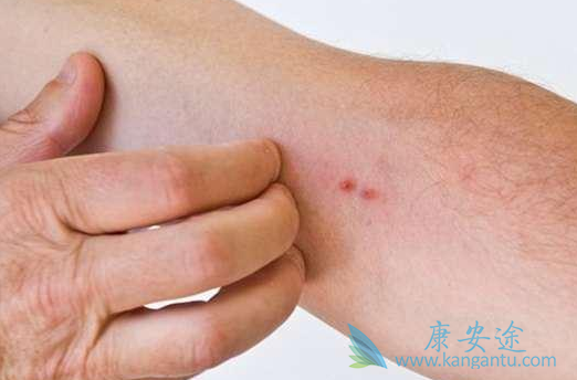 地塞米松 地塞米松