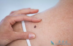 ���º�ɫ����������������Ҫ����Щ��