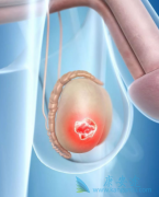 غ�������Ƕ���������غ������������ʲô֢״��