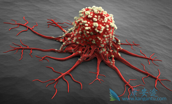 良性肿瘤与恶性肿瘤的区别 良性肿瘤与恶性肿瘤的区别